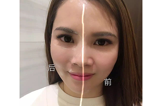 黄金棒效果怎么样 瘦脸嫩肤抗衰老作用一个都不落