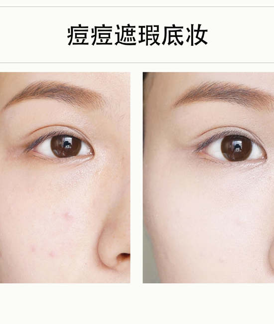 脸上长痘痘怎么化妆 遮瑕清透两不误底妆教程