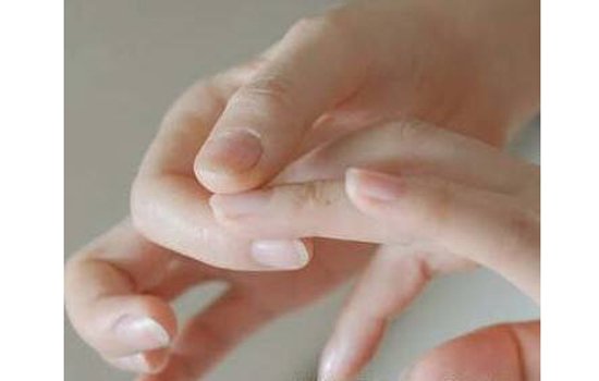 如何从指甲看健康状况 教你简单看指甲判健康