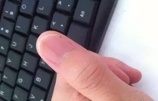 如何从指甲看健康状况 教你简单看指甲判健康