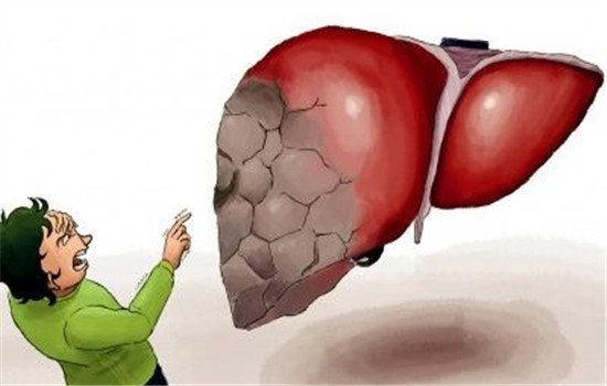 肝功能异常的原因 肝功能异常或是这8种原因