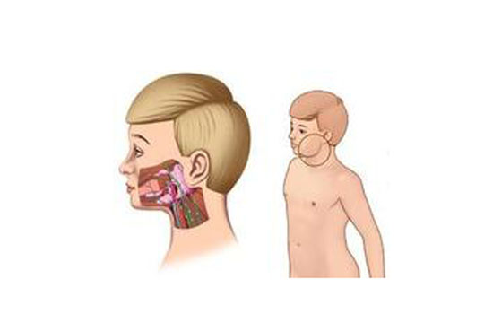 腮腺炎是怎么引起的 春季得小心腮腺炎