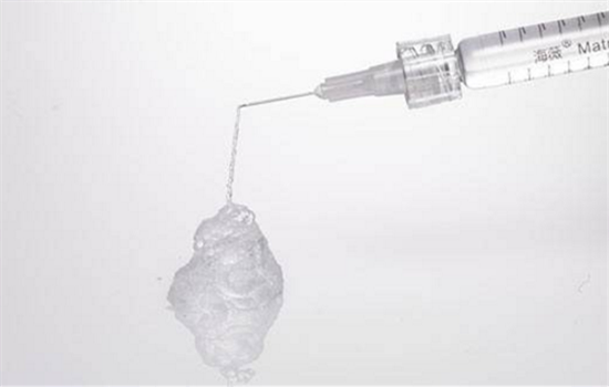 玻尿酸隆鼻外扩怎么办 外扩别急后悔药值得你试一试