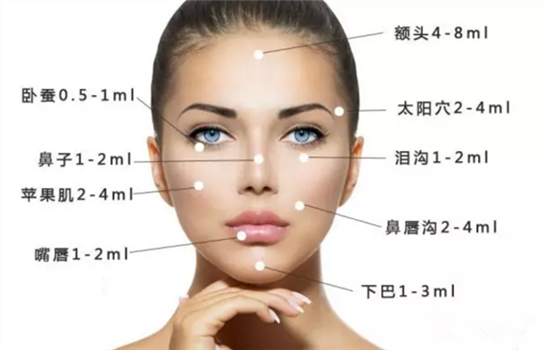 爱芙莱玻尿酸是大分子还是小分子 爱芙莱是用来干嘛的