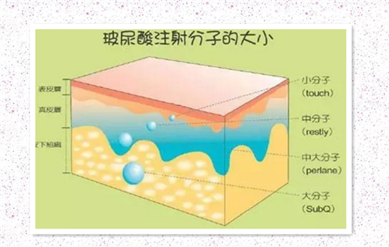 玻尿酸跟瘦脸针的区别 做微整形之前一定要弄清楚