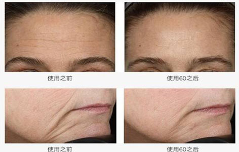 nuface美容仪好用吗 nuface的各大功能是真是假