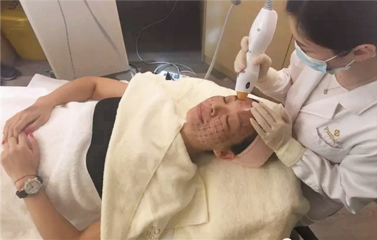 热玛吉多久可以见效 紧肤术后2-4个月会明显见效