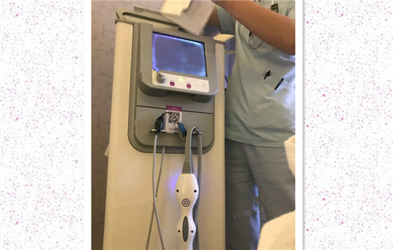热玛吉案例 真人案例告诉你做热玛吉感受如何