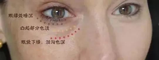 去眼袋眼霜推荐 赶走烦人黑眼圈
