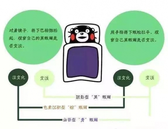 去眼袋眼霜推荐 赶走烦人黑眼圈