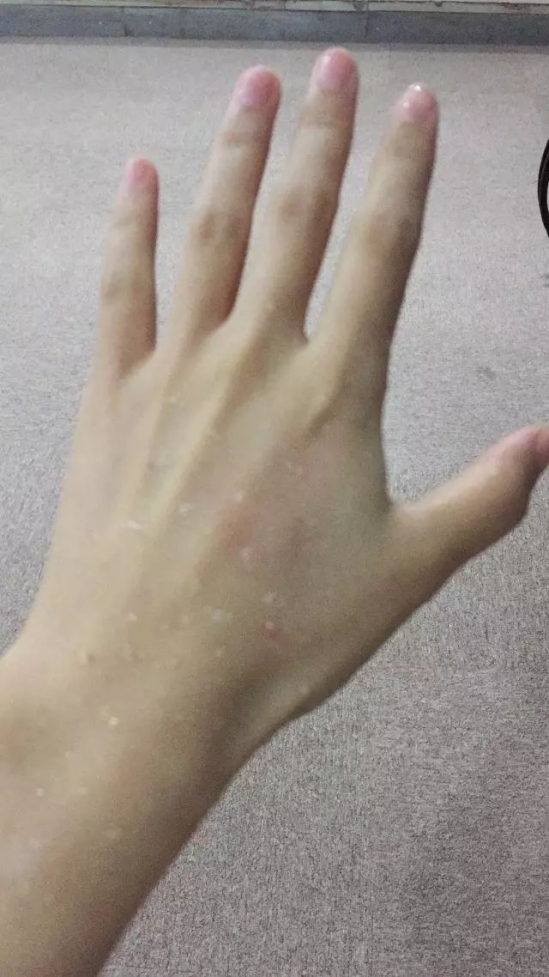 冬天补水用什么护肤品 这款补水神器最适合爱白嫩的你