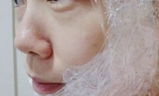 怎么变V字脸  变美变年轻变V脸的秘诀