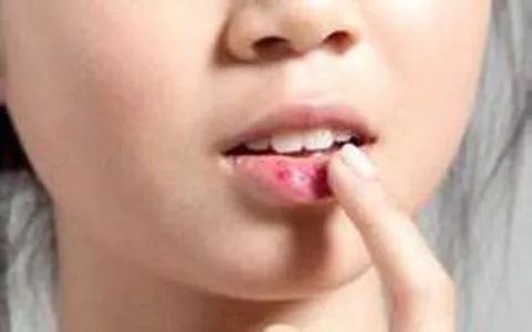 冬季唇部怎么护理 你的嘴唇涂口红也能比别人美啦