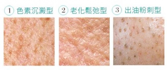 怎么解决毛孔粗大的问题  怎么缩小毛孔