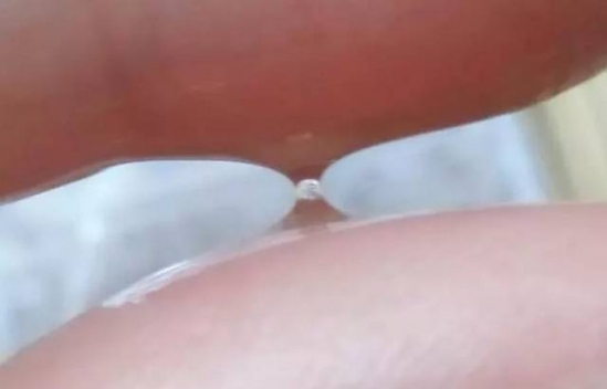 去黑头的最好方法  让颜值天敌黑头消失无踪的利器
