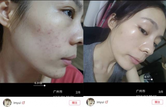 爽肤水哪个牌子好 10款好用爽肤水，烂脸也能救