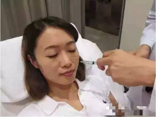 法令纹怎么消除    脸上有如此显老的法令纹该怎么办呢