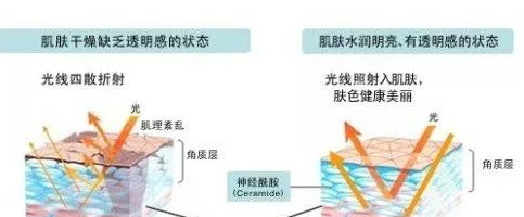 红血丝用什么护肤品好 这些护肤品才适合激素皮炎使用