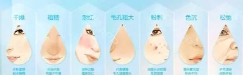 红血丝用什么护肤品好 这些护肤品才适合激素皮炎使用
