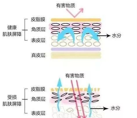 红血丝用什么护肤品好 这些护肤品才适合激素皮炎使用