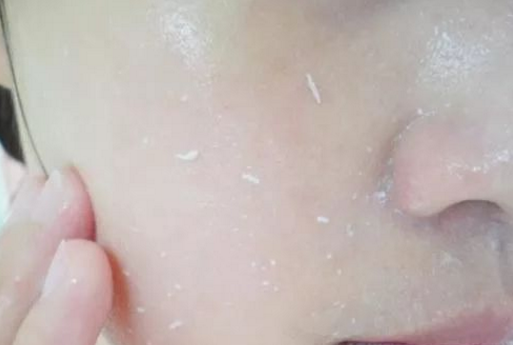 怎么解决皮肤暗黄 摆脱暗黄拥有白皙肌肤的方法