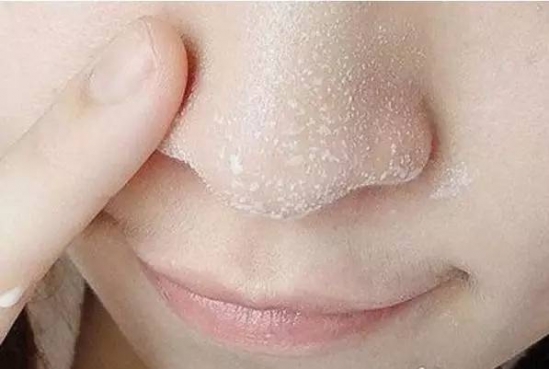 怎么洗脸对皮肤好 没想到这些东西还能用来洗脸