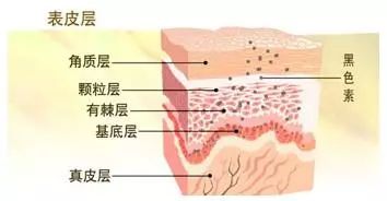 黑色素怎么去除 脸上的痘印不消原来是它在作怪