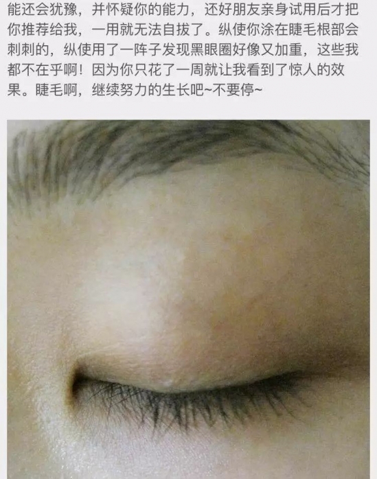 怎么让睫毛变长变浓密   迷人双眼的标配不就是纤长的睫毛吗