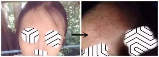 面膜可以天天敷吗   天天都敷面膜的仙女们是不想要你们的脸蛋了吗