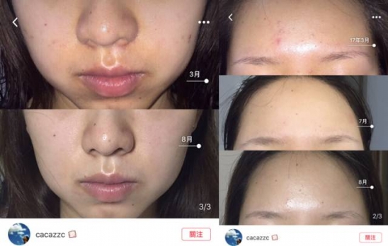 爽肤水哪个牌子好 10款好用爽肤水，烂脸也能救
