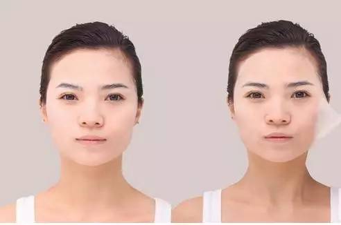 收缩毛孔的小偏方 教你怎么有效收缩毛孔