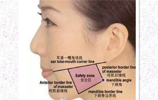 瘦脸针可以用针灸恢复吗 揭秘注射肉毒素恢复的秘密