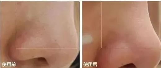 洗脸加什么护肤好吗 洗脸加点这些想有皱纹都难