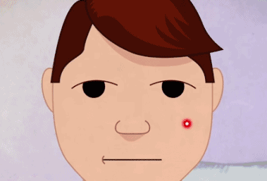 鼻子上的黑头怎么去掉 这是消灭“草莓鼻”最有效的方法！