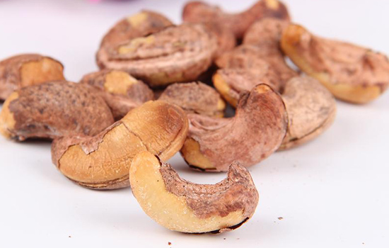腰果的皮可以吃吗 生腰果果壳和种皮有毒