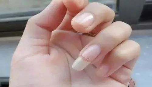 指甲出现斑点怎么回事 这些指甲斑点预示着的发生