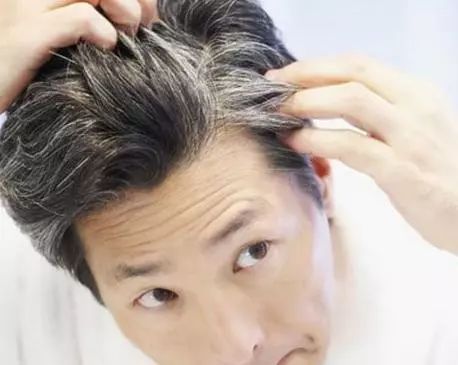 长白发预示着什么 长白发的位置暗示你的身体状况