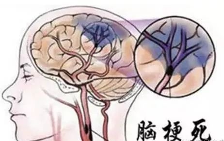 复方黄芪粥的作用与功效 常喝它让你血液畅通无阻