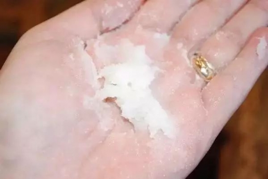 冬季手干裂解决妙招 教你几招护理手的好方法
