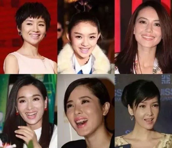 如何选择合适的口红颜色 看牙齿和肤色很关键