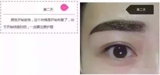 纹眉七天的变化 小仙女快看过来吧