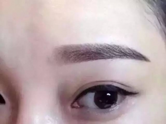美瞳线的危害 美瞳线别瞎搞，低调点最好！