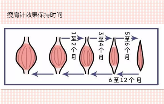 瘦肩针打几次可以定型 永久定型只是广告宣传词