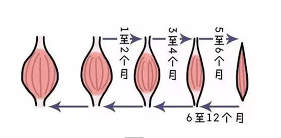 瘦肩针可以缓解疲劳吗 能缓解疲劳但也不是人人可以打