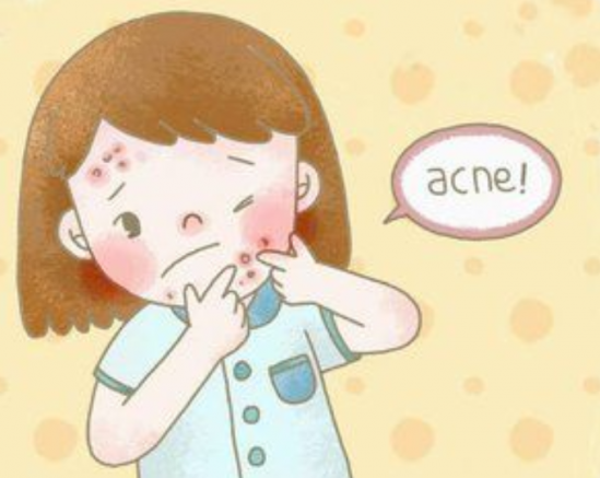 怎样去痘痘和痘印 防止痘痘反复