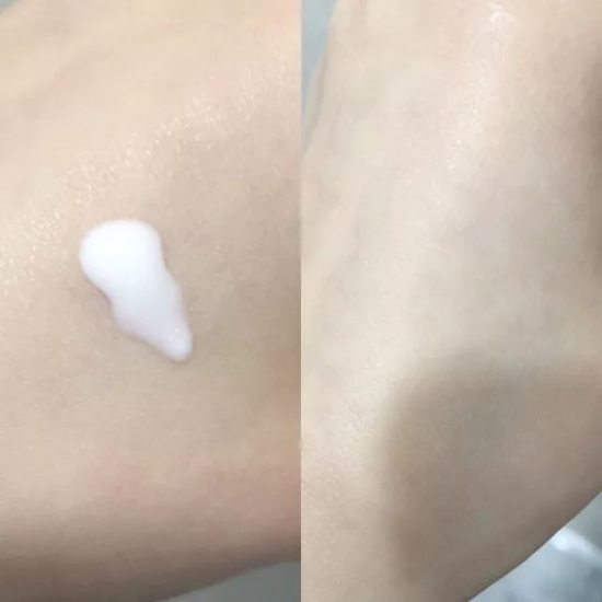 祛痘排行榜十强 战斗值爆表的战痘机
