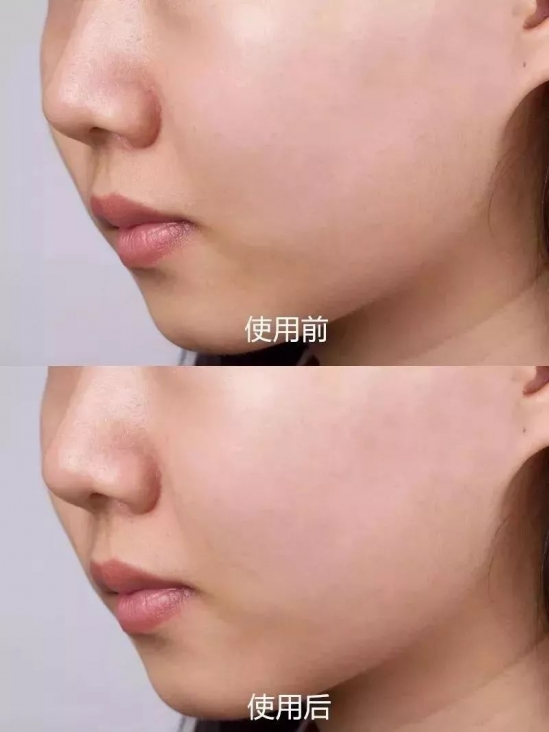 olay美白精华哪款好 美白性价比之王olay