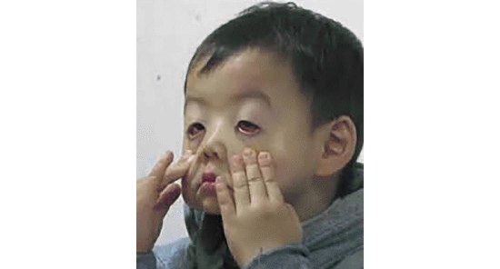 资生堂新透白精华好用吗