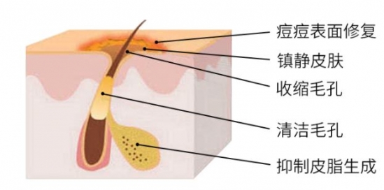 美白护肤品哪个好