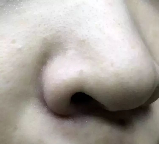收缩毛孔洗面奶排行榜